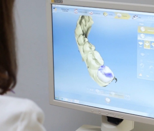 Doctor Berkal looking at digital models of teeth on computer screen