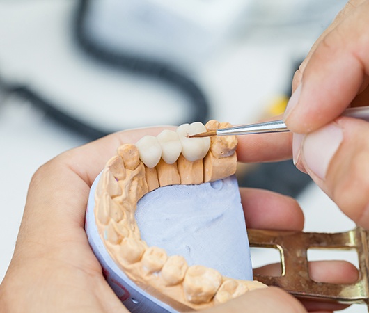Dental technician building a dental bridge