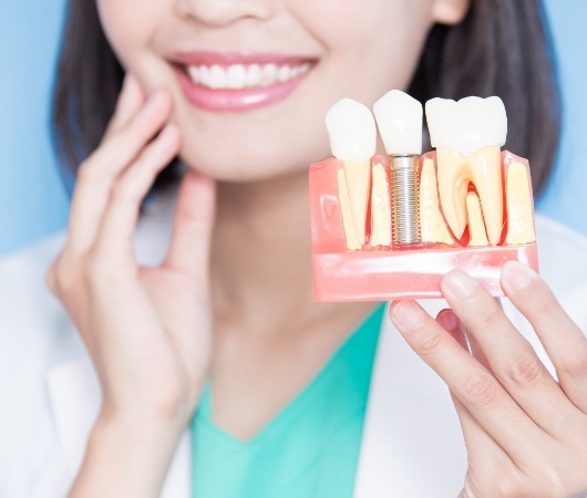 Smiling dentist holding model of dental implant