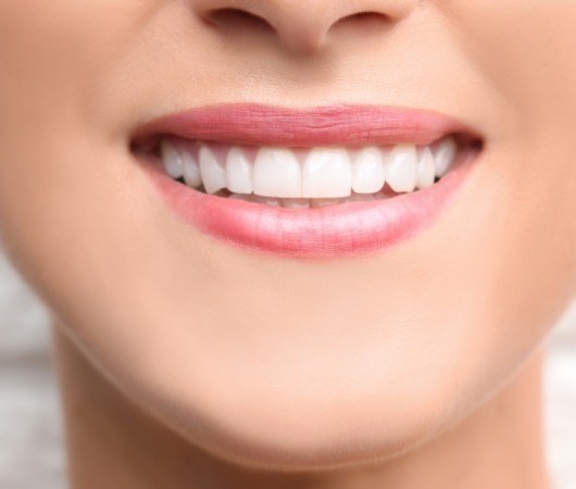 Close up of person smiling with straight white teeth