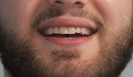 Close up of man with slightly yellowed teeth