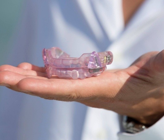 Dentist holding light purple occlusal splint in their hand